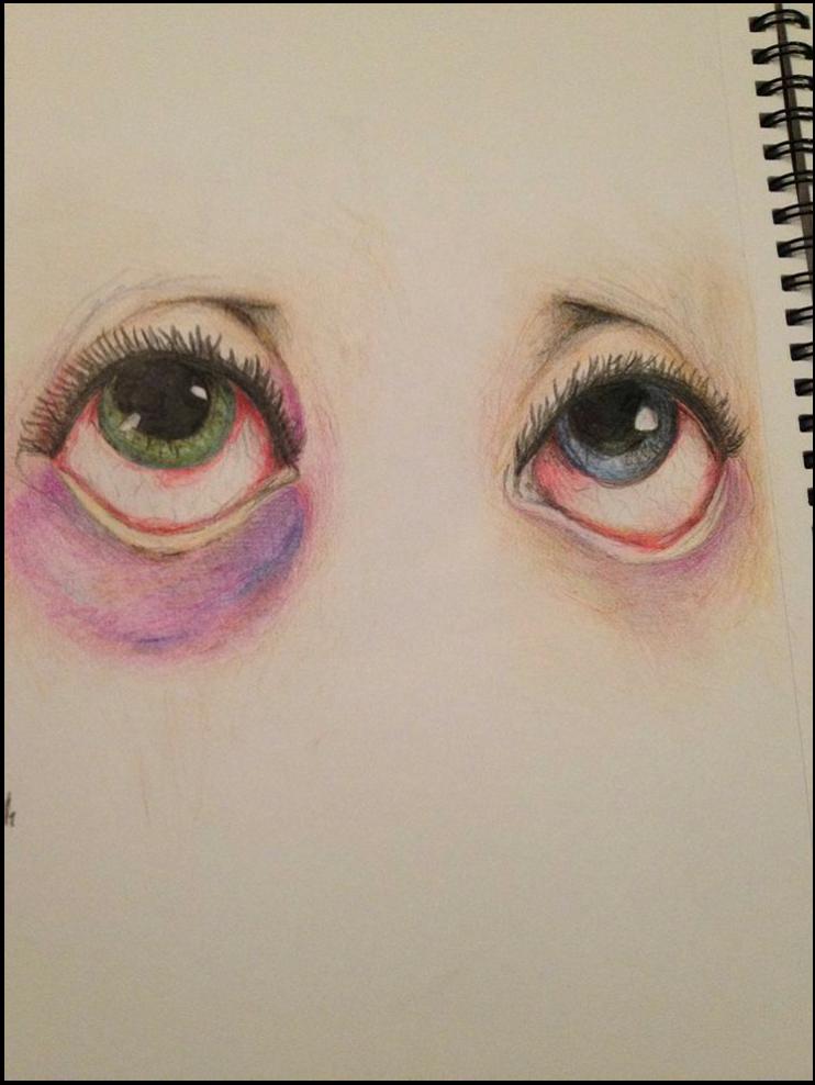 A pencil drawing depicts two eyes with contrasting pupil colors (green and blue) and eyelashes. A purple patch is visible on the left eye. The drawing is done on a light-colored surface, possibly a page from a sketchbook.